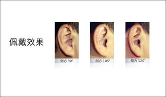 赣州助听器：帮助听力障碍者重获听力的利器